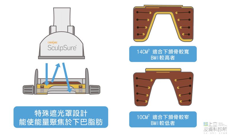 SculpSure絲酷秀提供2個尺寸的特殊遮光罩，可以根據個人狀況使用