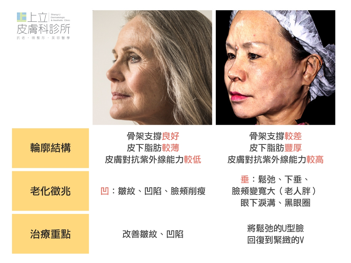 西方白種人相比，亞洲人的臉部視覺年齡普遍來說會年輕一些