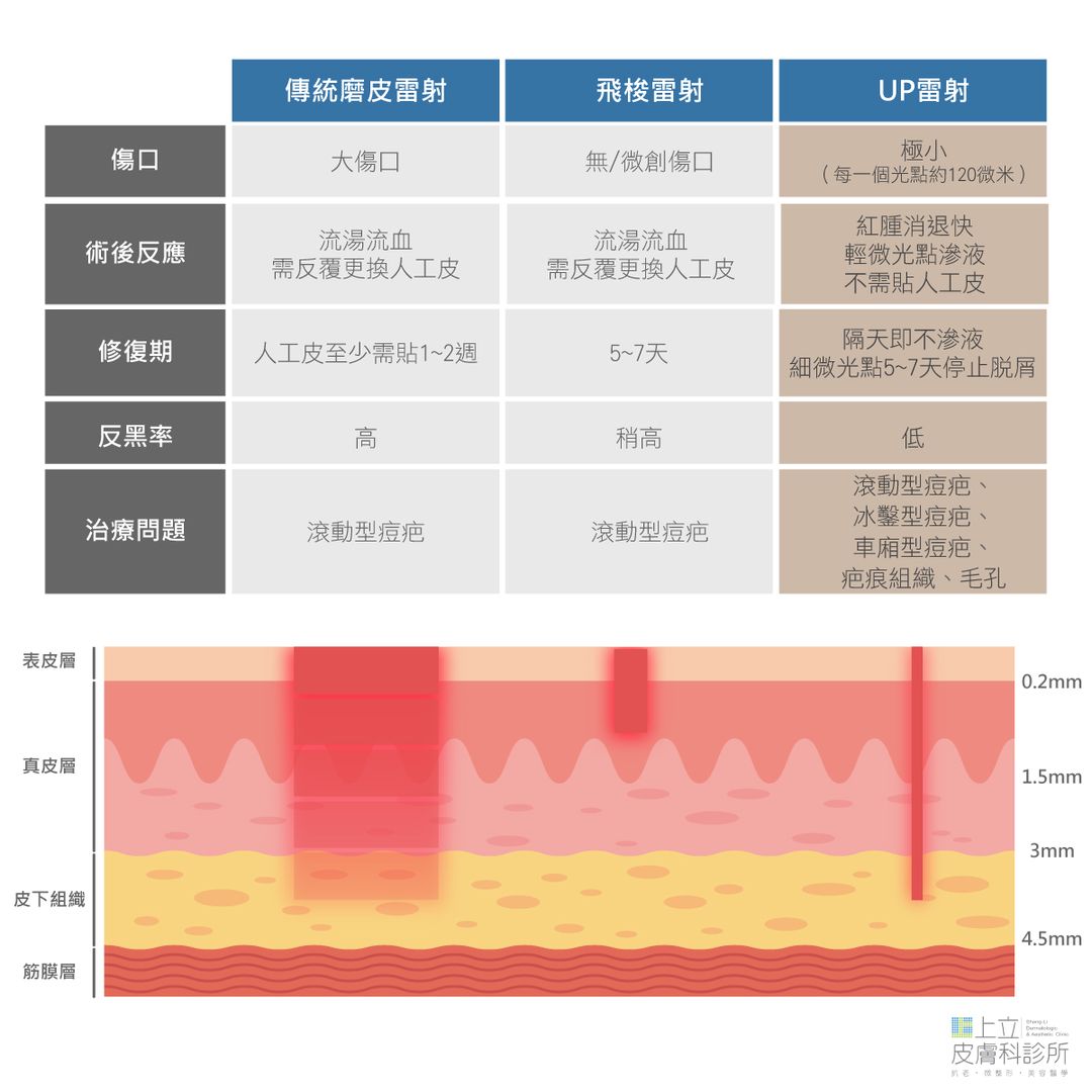 傳統磨皮雷射、飛梭雷射和UP雷射的治療方式比較