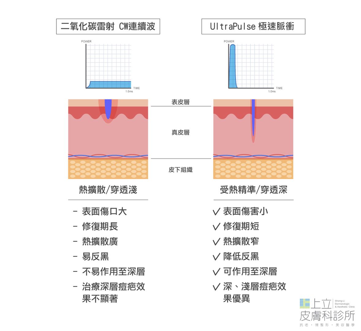 UltraPulse極速脈衝輸出特色