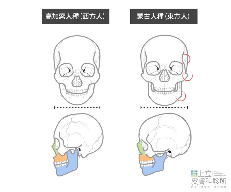 亞洲人天生骨架就比西方人更扁、更塌一些，甚至經常會有下巴後縮