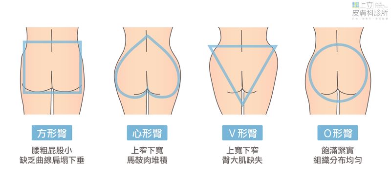 臀部形狀則可以大致歸類為方形臀、心型臀、Ｖ型臀、圓形臀