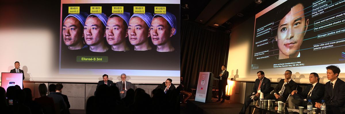 2020巴黎世界美容醫學大會IMCAS，針對亞洲男性、女性，運用一樣的材質來達到更好拉提、改善皺紋的效果。
