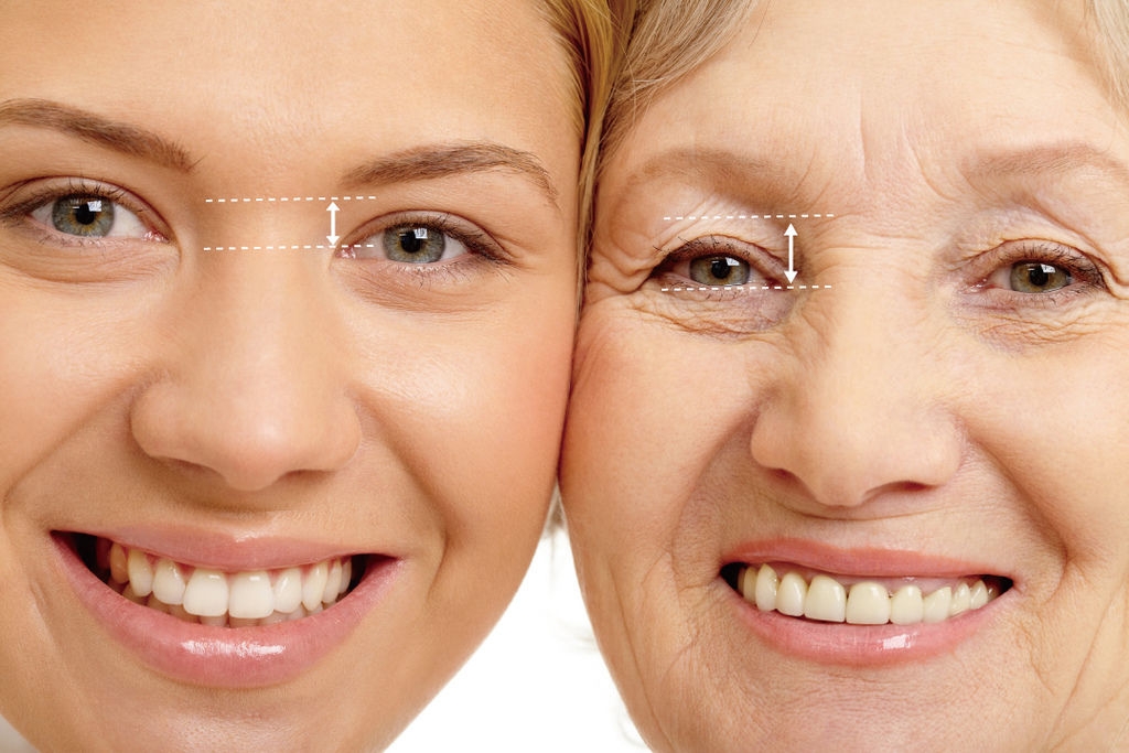 年紀增長，眉頭與眼頭距離比較近，二者距離卻會變得愈來愈開