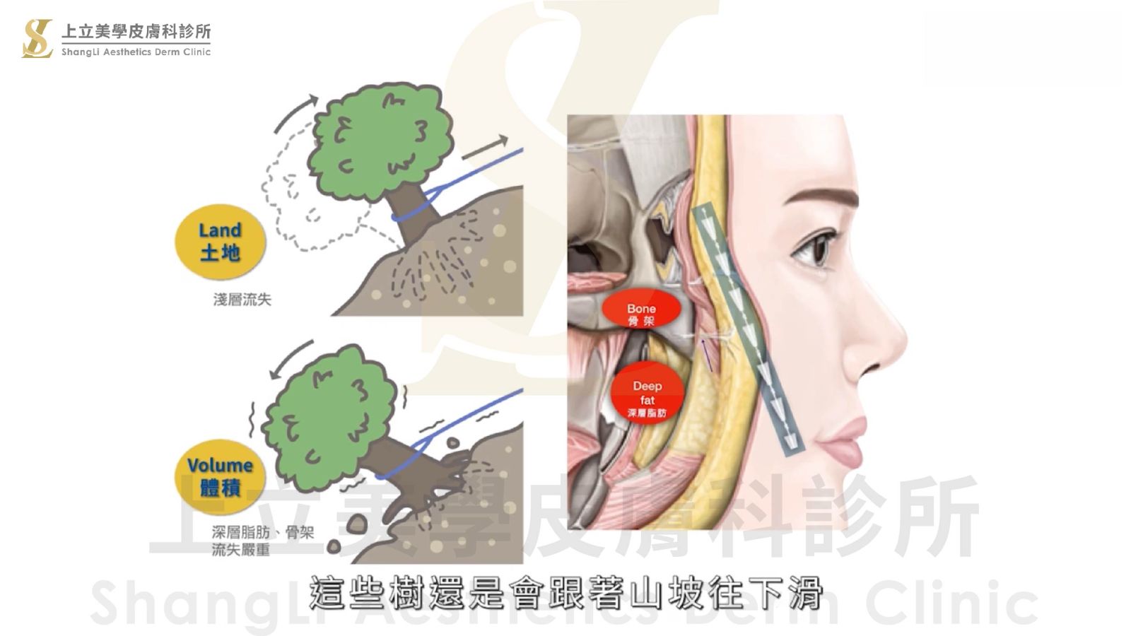 為什麼我選擇的拉提方式都沒有效？