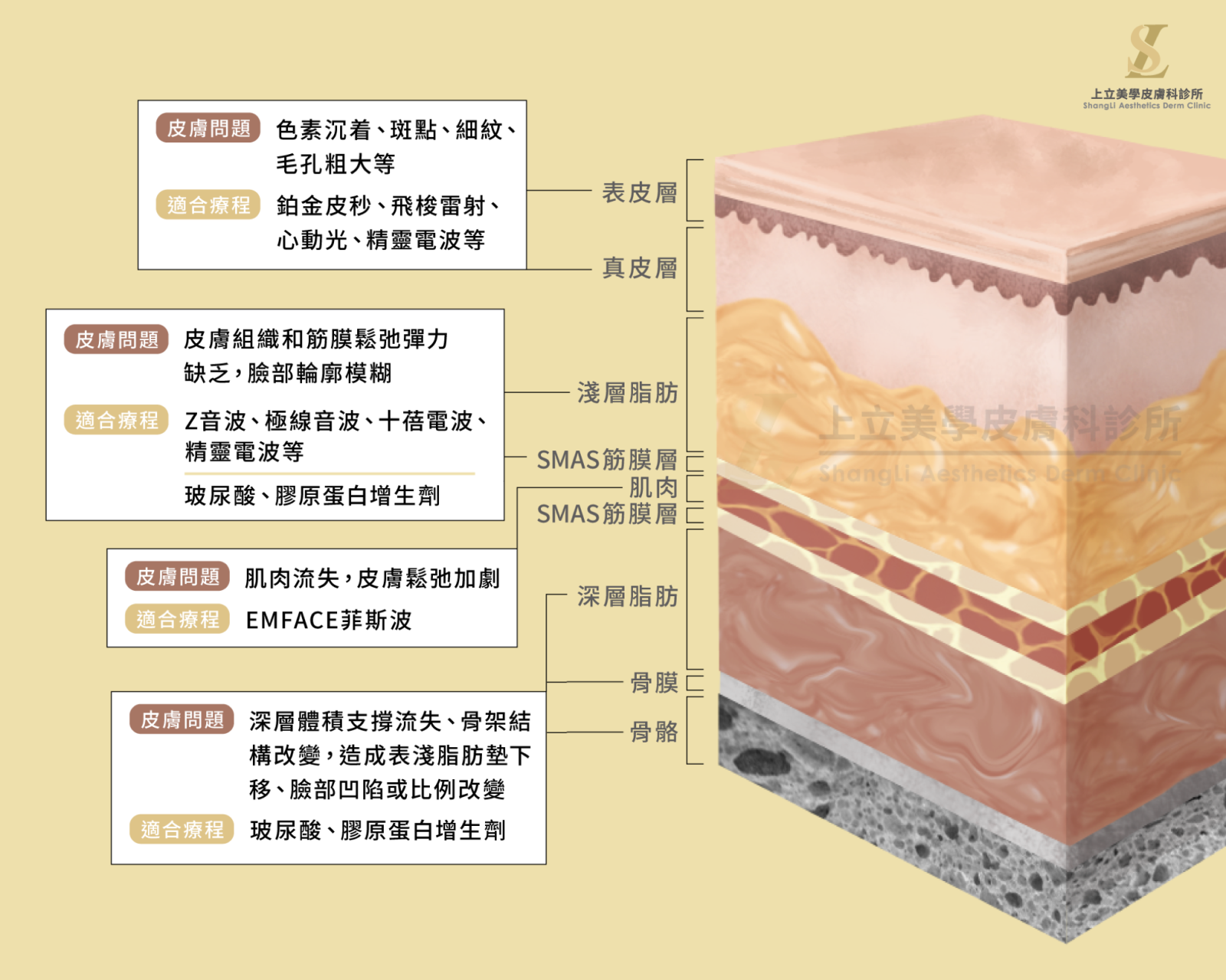 若是表皮層、真皮層的膚質改善，則能合併微針電波共同改善。