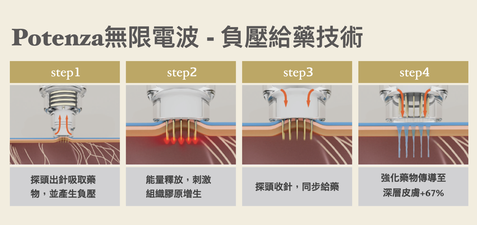 Potenza無限電波的專利藥物傳導技術