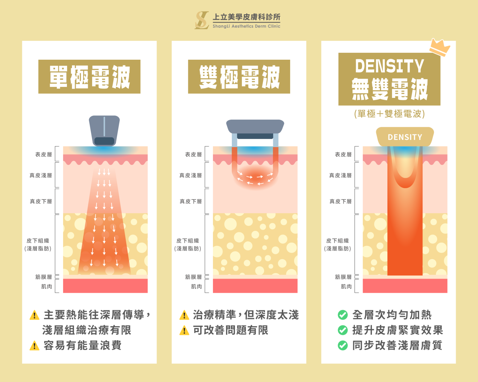 DENSITY無雙電波,同時提供的「單極電波」和「雙極電波」二種次脈衝