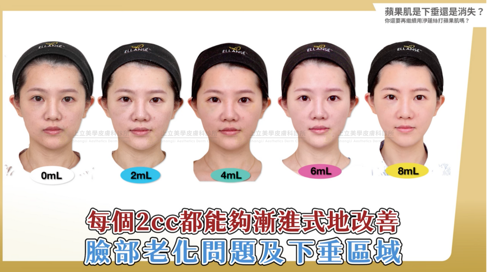 善用ELLANSÉ洢蓮絲的累加性特色，假如不想要讓臉部一下子變化太大
