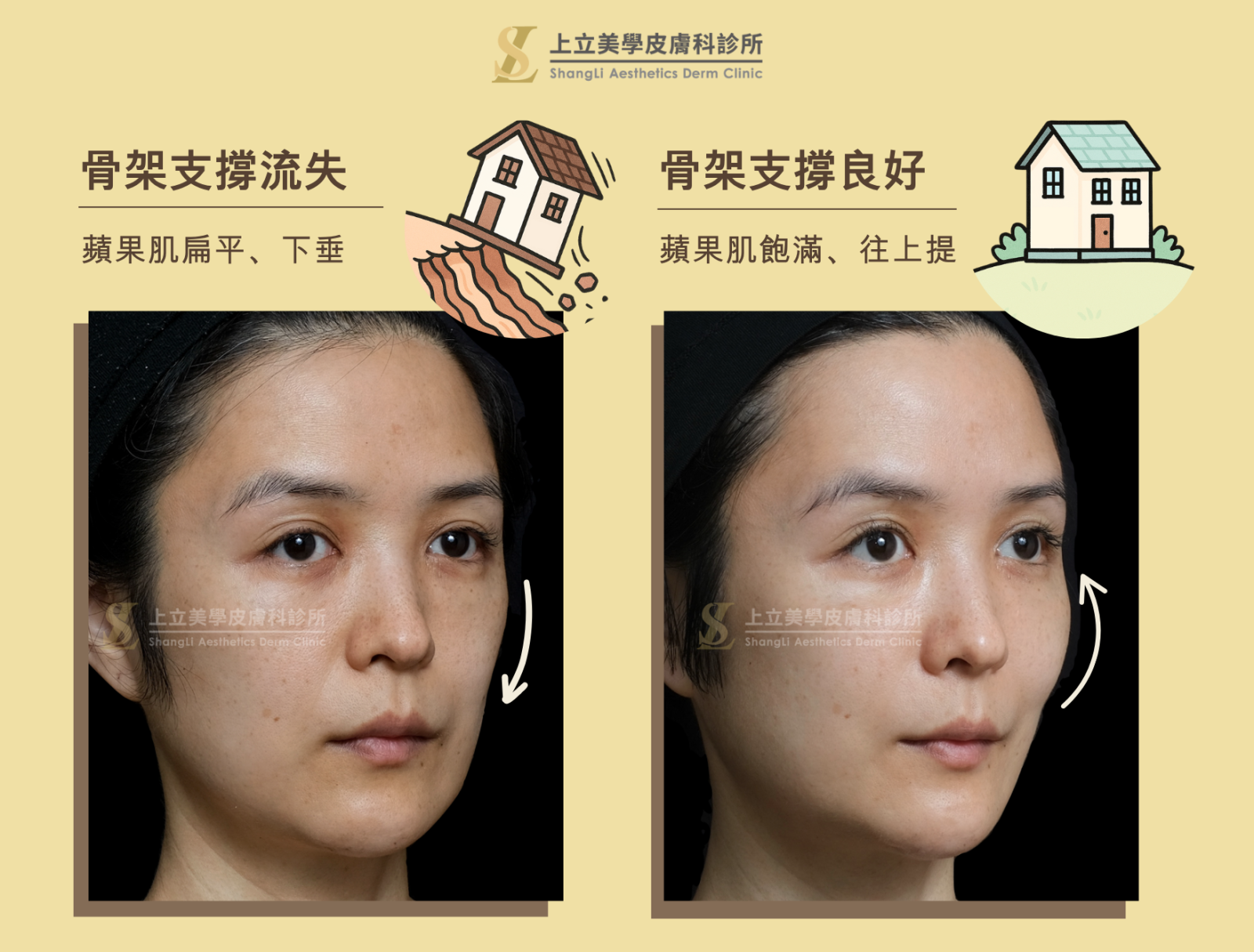 骨架和皮膚之間的關係，就像一棟蓋在山坡上的建築，骨架是地基、皮膚是房子。