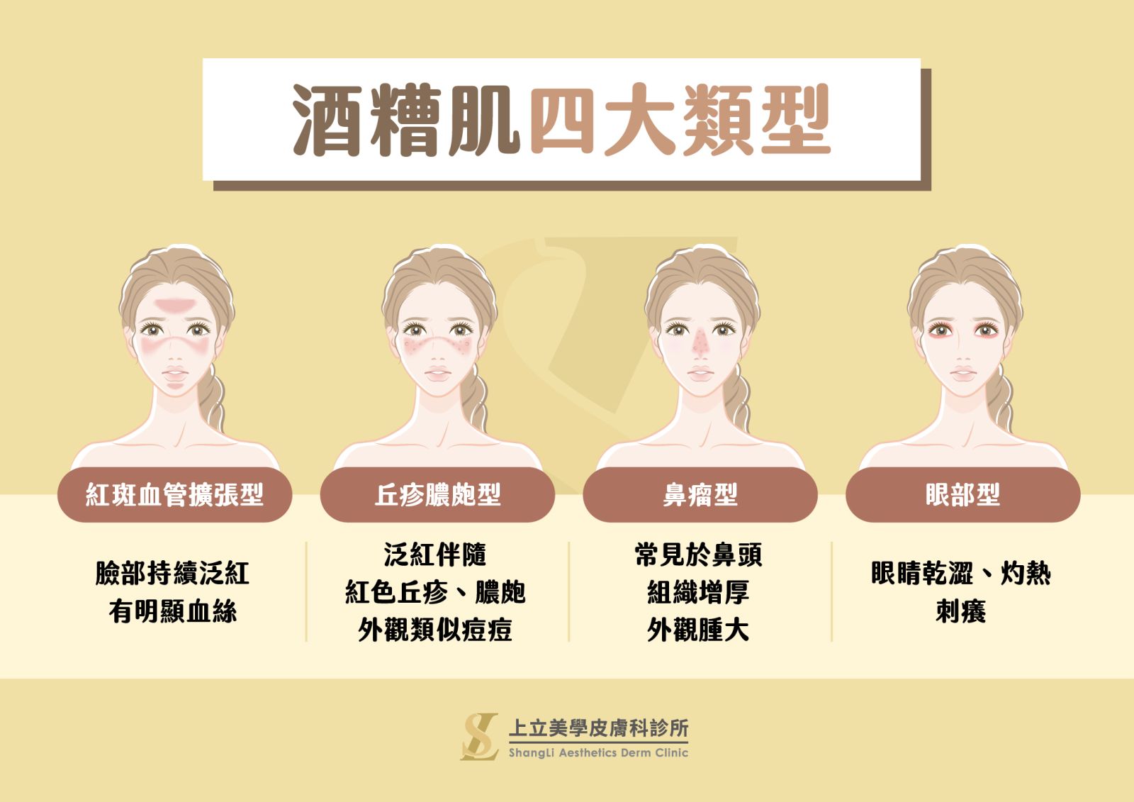 怎麼判斷酒糟肌？四大類型與好發族群看這裡