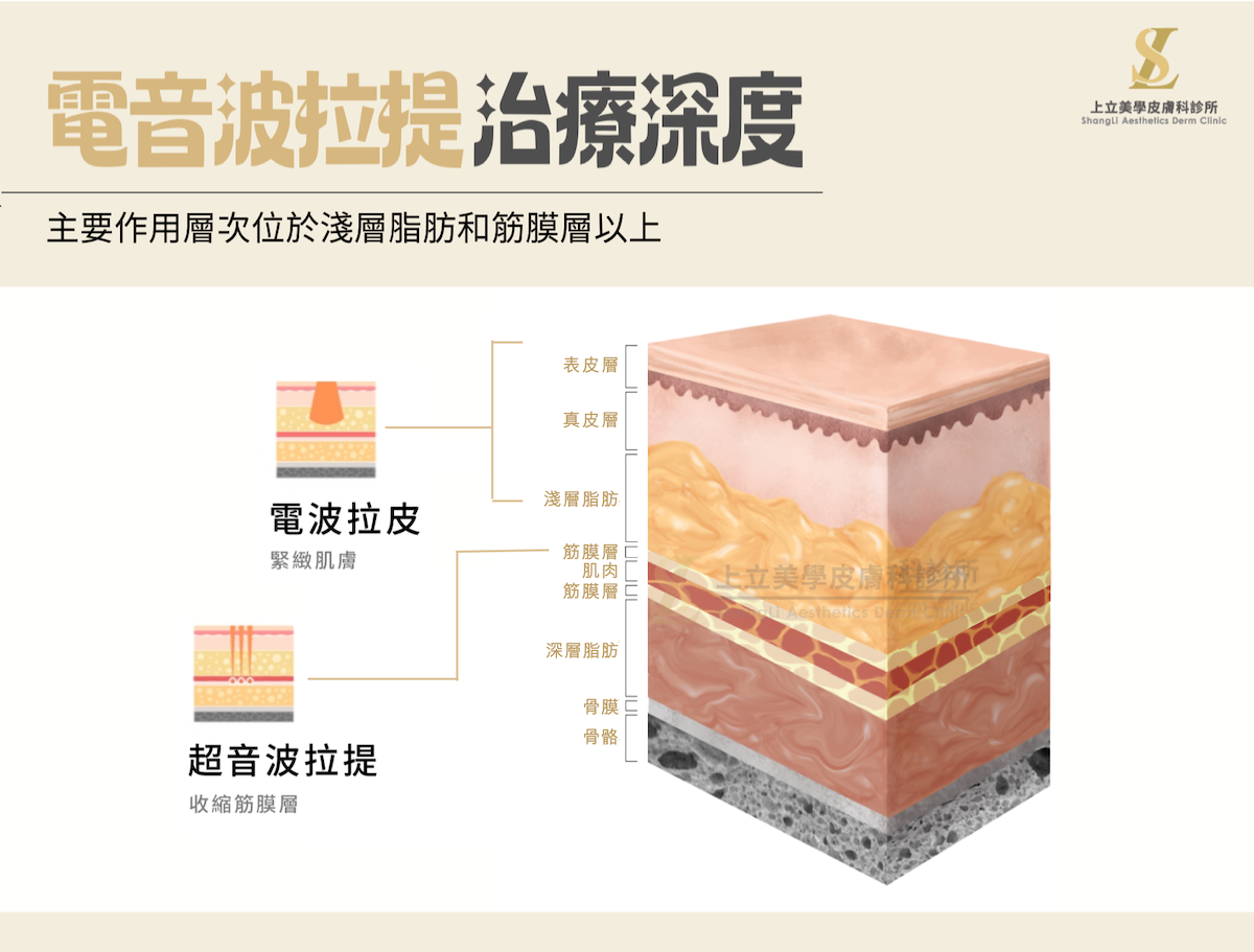 電音波拉提皮膚治療深度