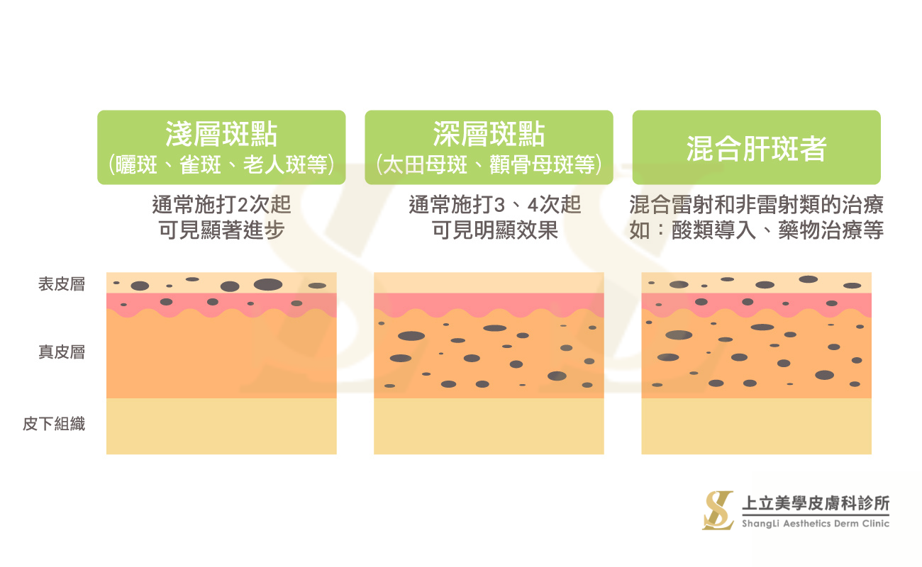 皮秒雷射除斑次數要做幾次？