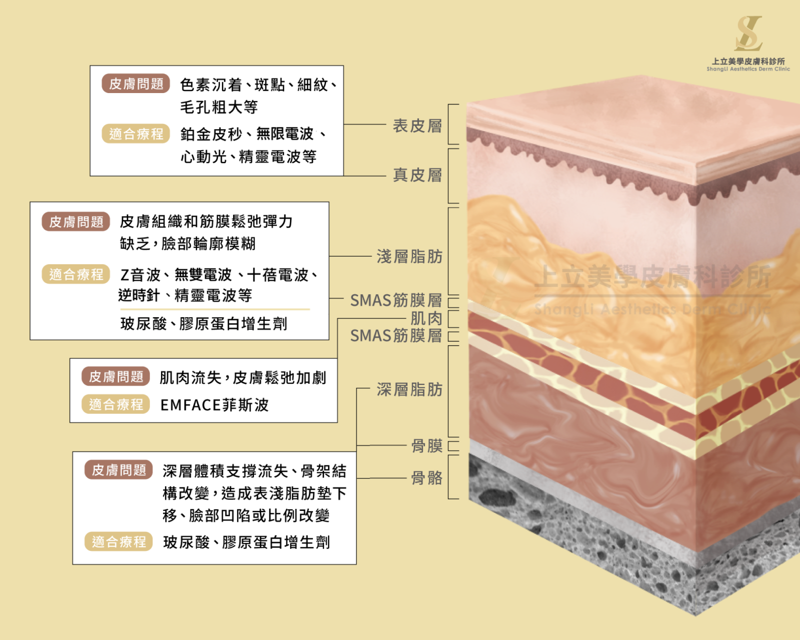 肌肉張力流失，則需要依賴「EMFACE菲斯波」