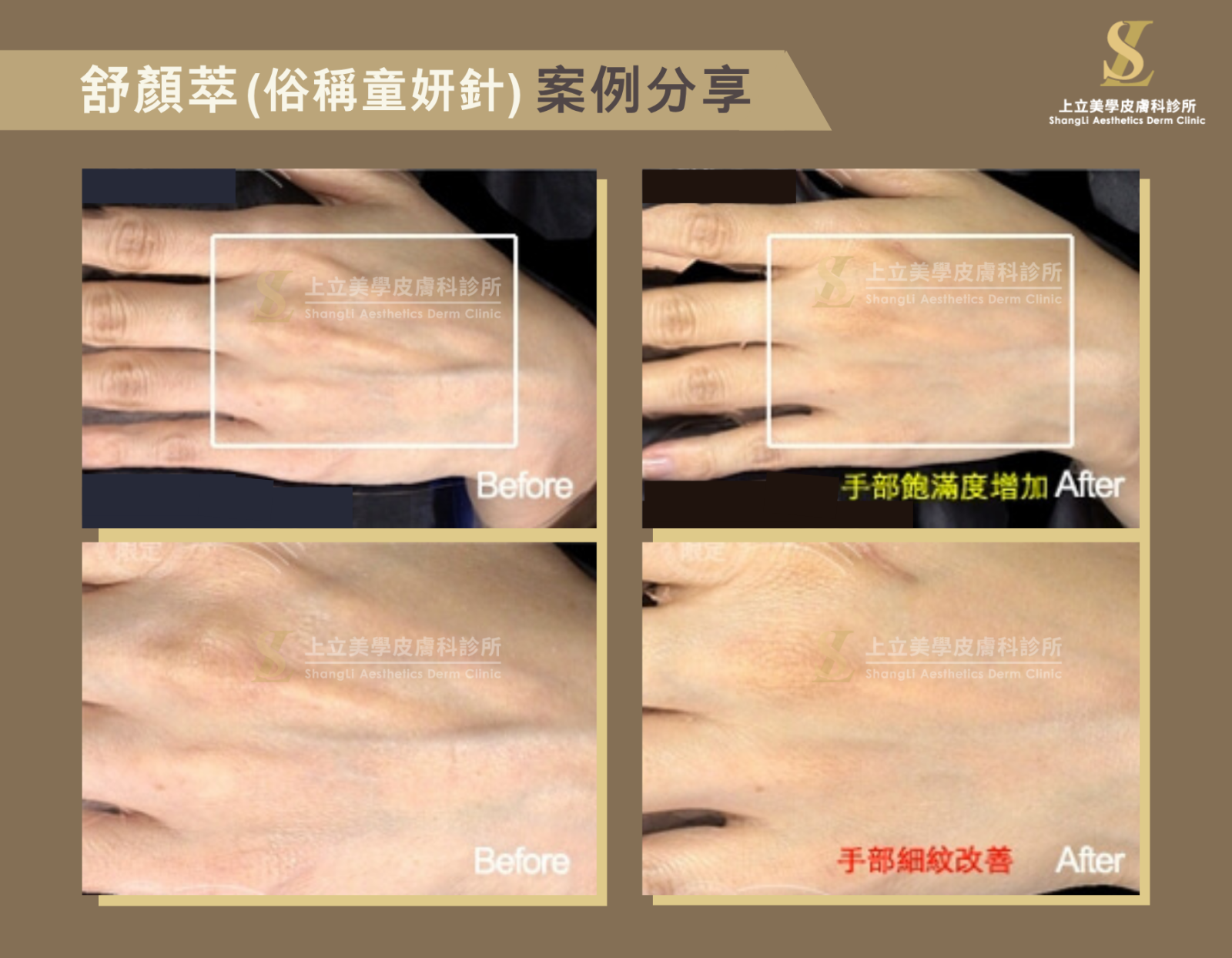 手部飽滿度增加,細紋改善