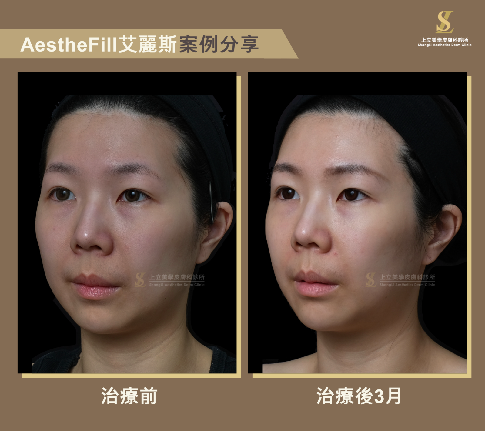 深層撐起立體感ｘ淺層精雕細緻膚質