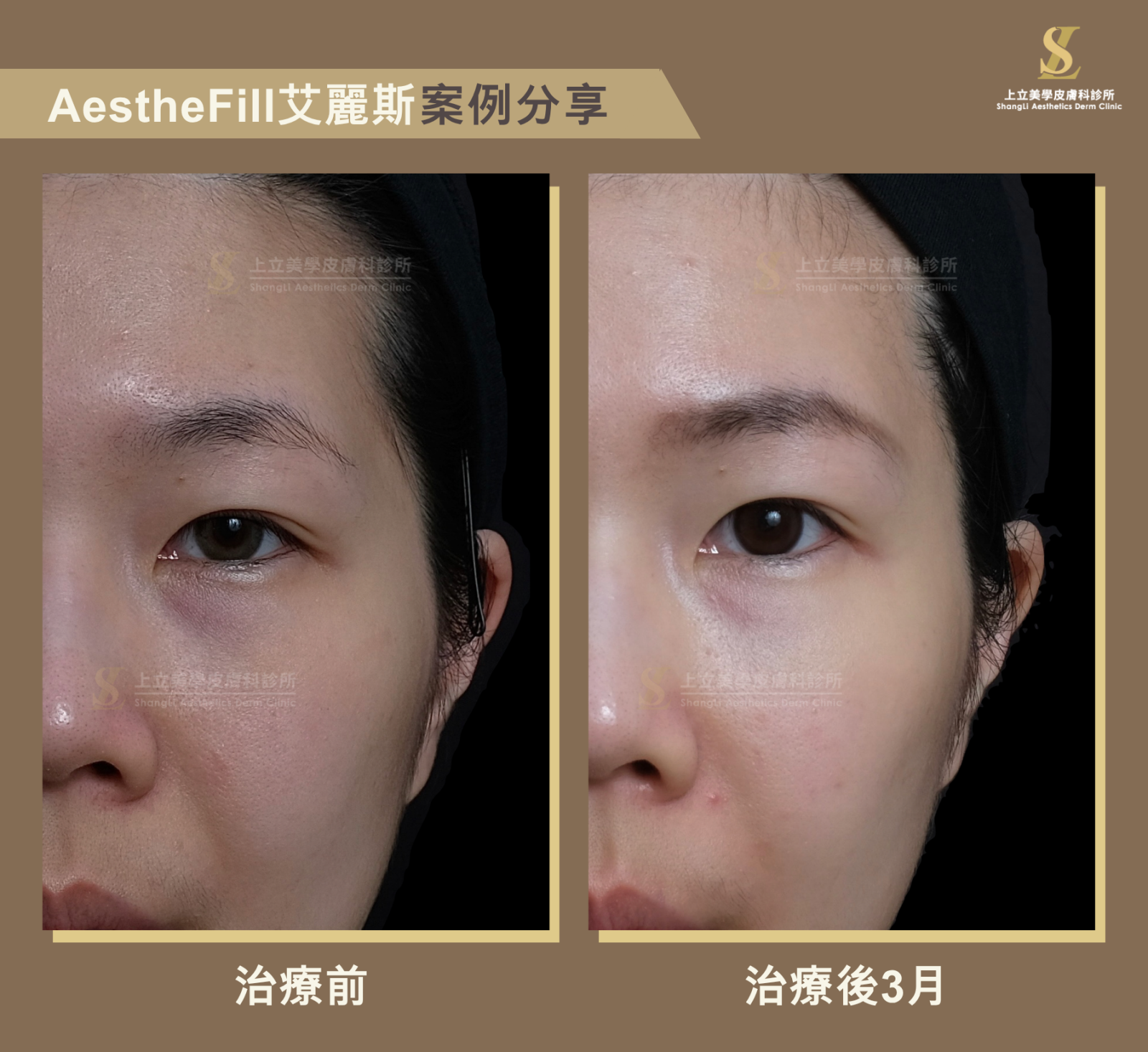 深層撐起立體感ｘ淺層精雕細緻膚質