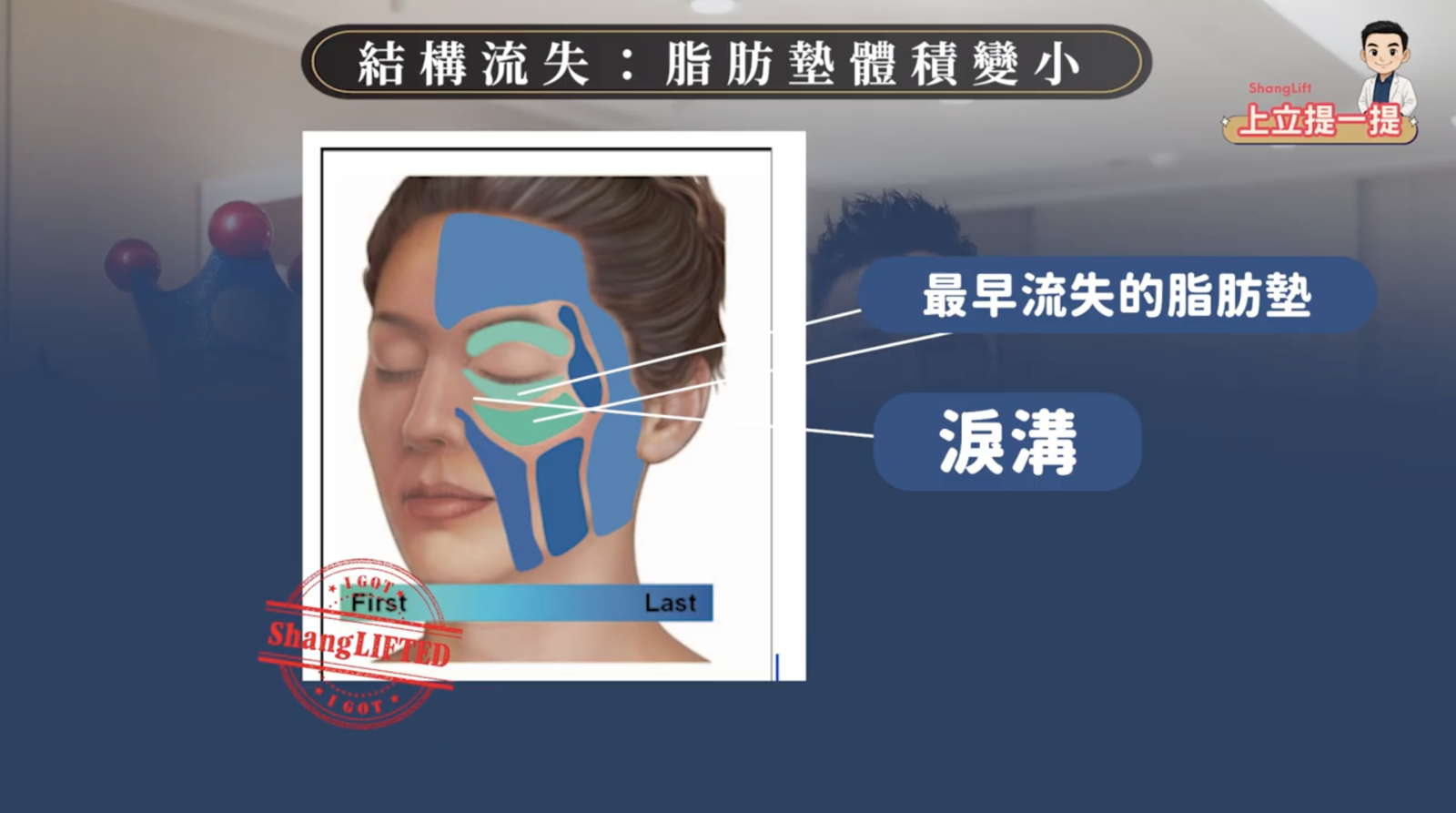 眼睛下方的二塊淺綠色區域是臉部深層脂肪最早流失的區域，而在這兩個脂肪中間形成的凹陷紋路就是淚溝