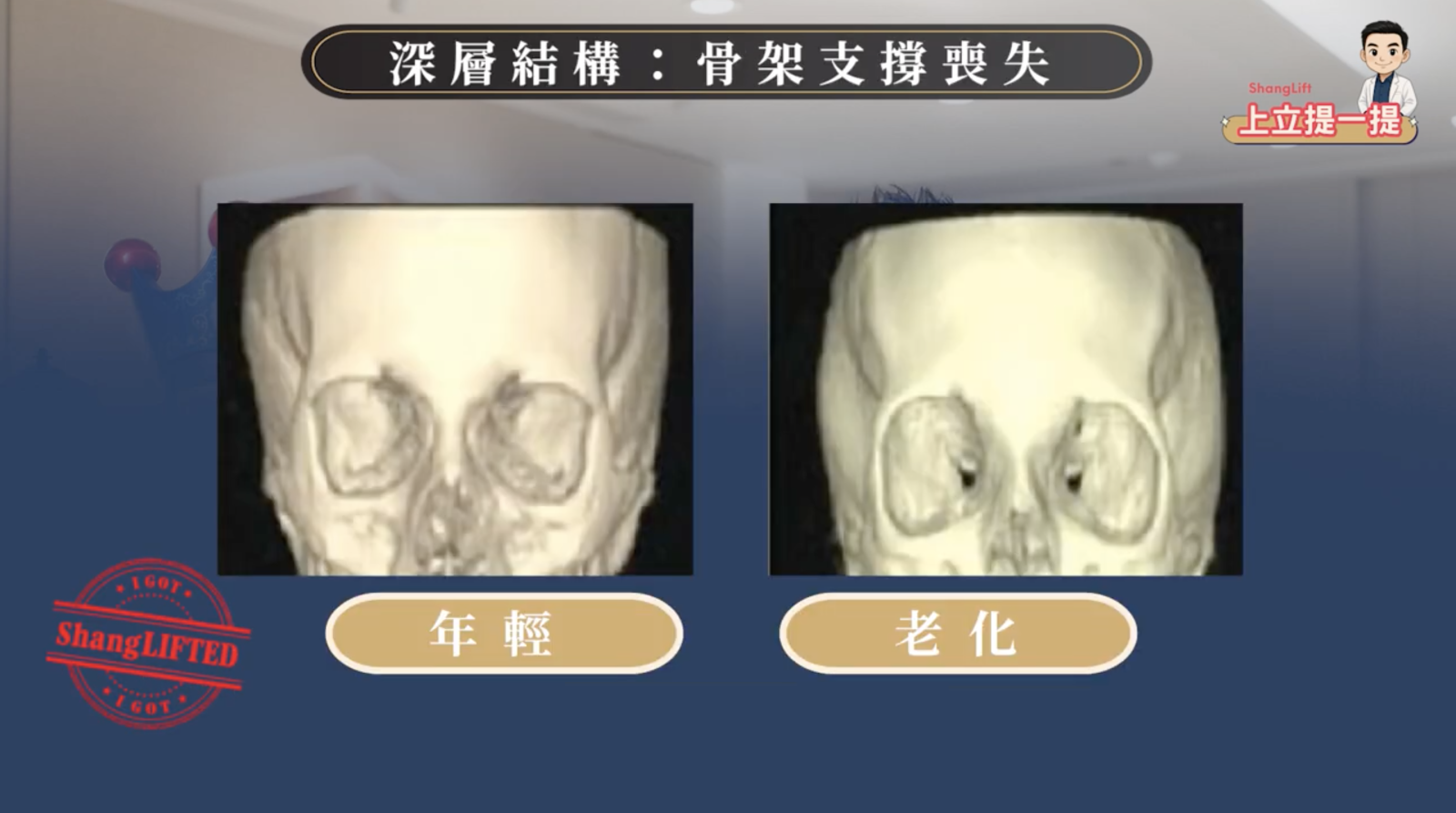 在老化流失的過程中，眼眶骨中央的凹洞會逐漸擴大，導致眼下脂肪失去支撐開始往下滑，而在眼眶下緣、眼袋內側或下方形成一道新月形凹痕。