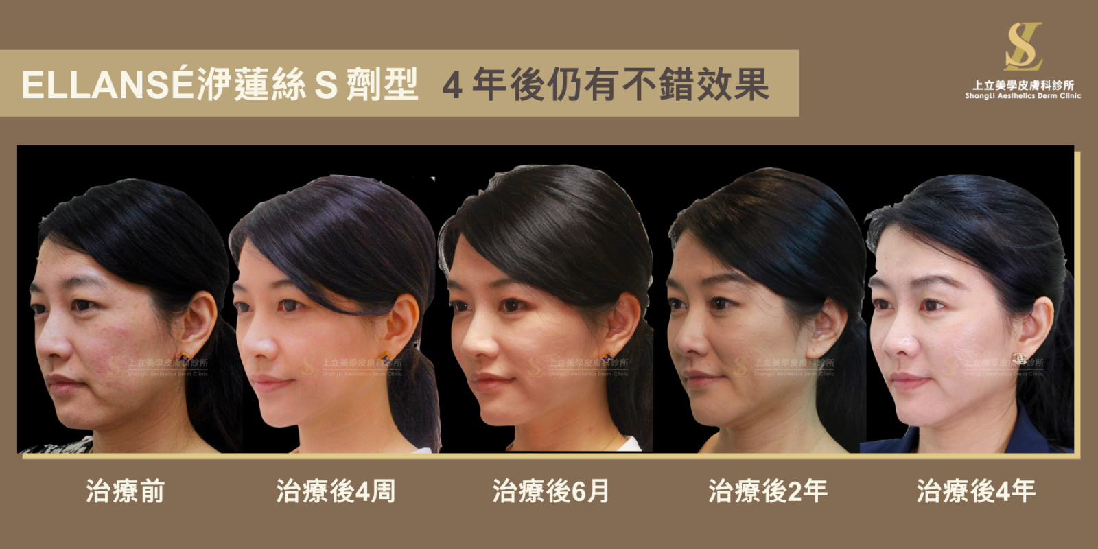ELLANS&Eacute;洢蓮絲可以穩定維持很長的時間