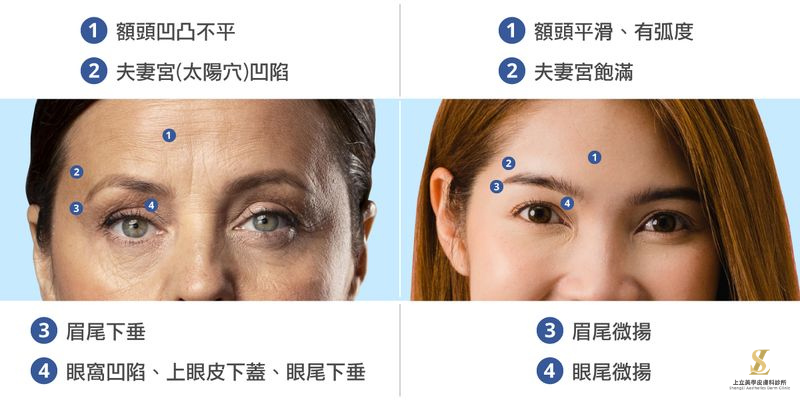 比較年輕的臉與老化的臉