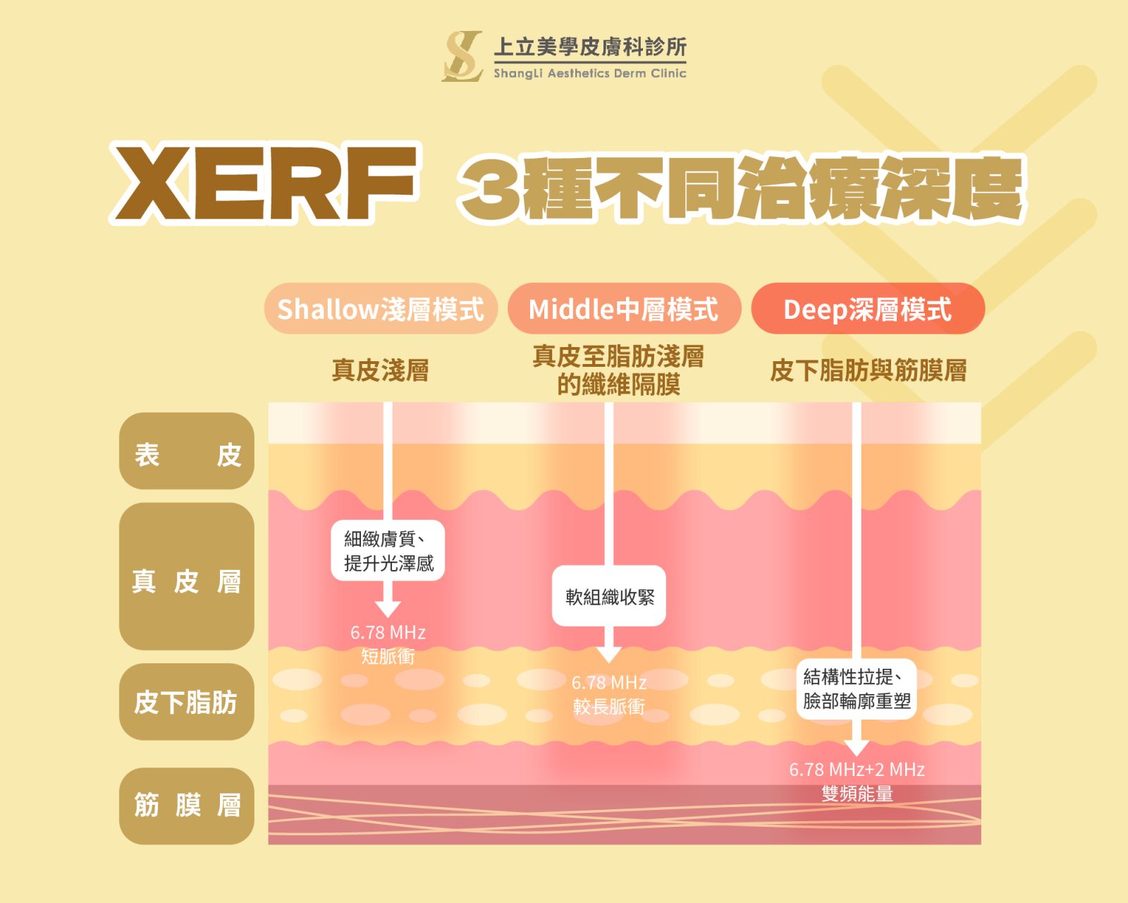三種深度模式，真正做到客製化治療