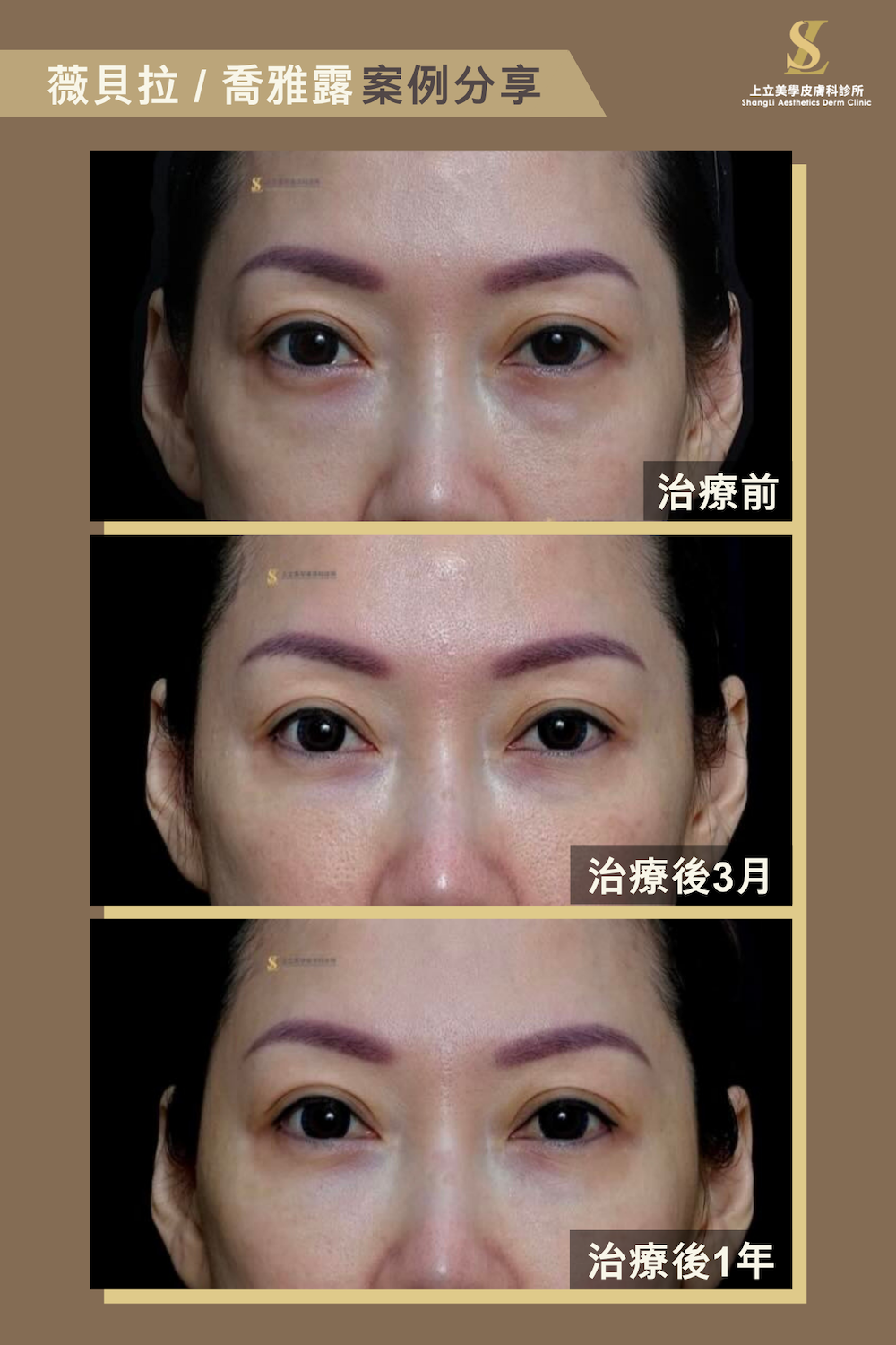 大小分子薇貝拉,重建結構並優化膚質