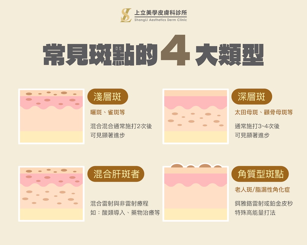 斑點的顏色、深度與皮膚構造不同