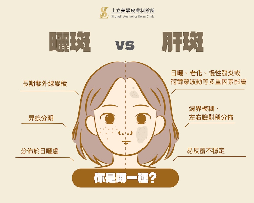 肝斑和曬斑