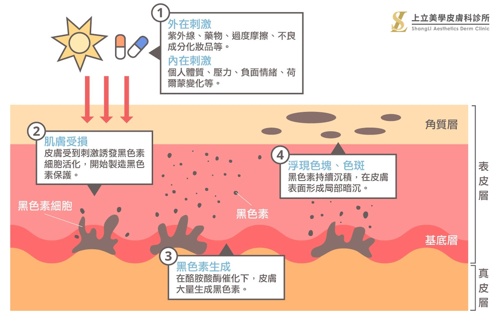 斑點種類