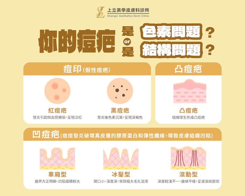 依型態分流治療