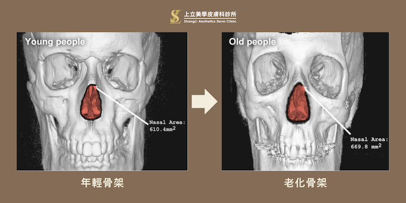 年輕骨架與老年骨架