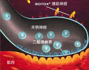 林上立診所Botox肉毒桿菌注射